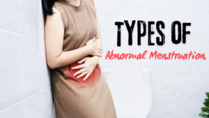 Types of Abnormal Menstruation